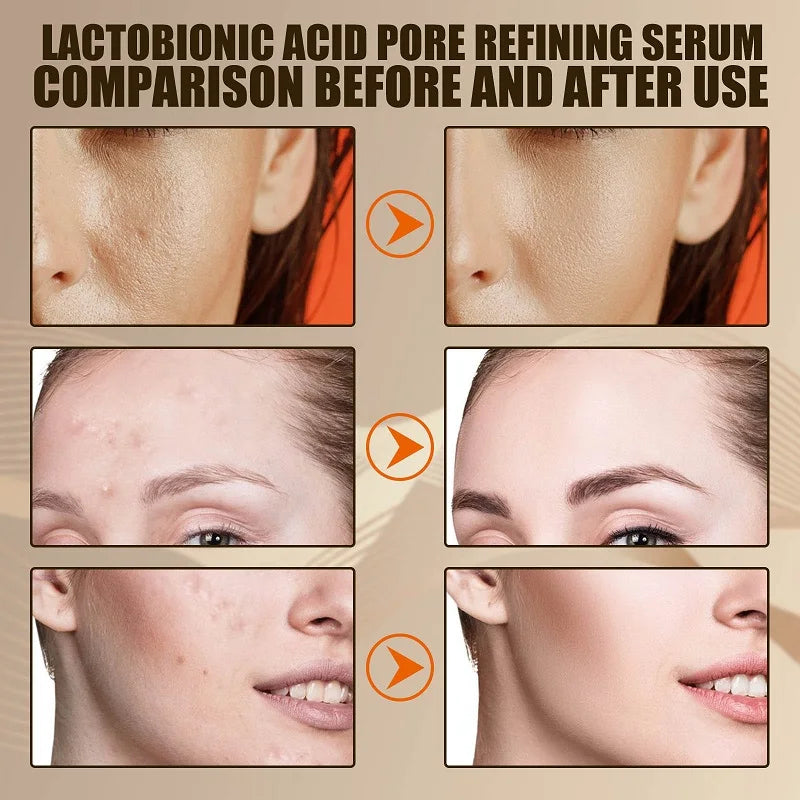 Lactobionic Acid Pore Shrink Face Serum Hyaluronic Acid Moisturizing Nourish Smooth Pores Repair Essence Firm Korean Cosmetics