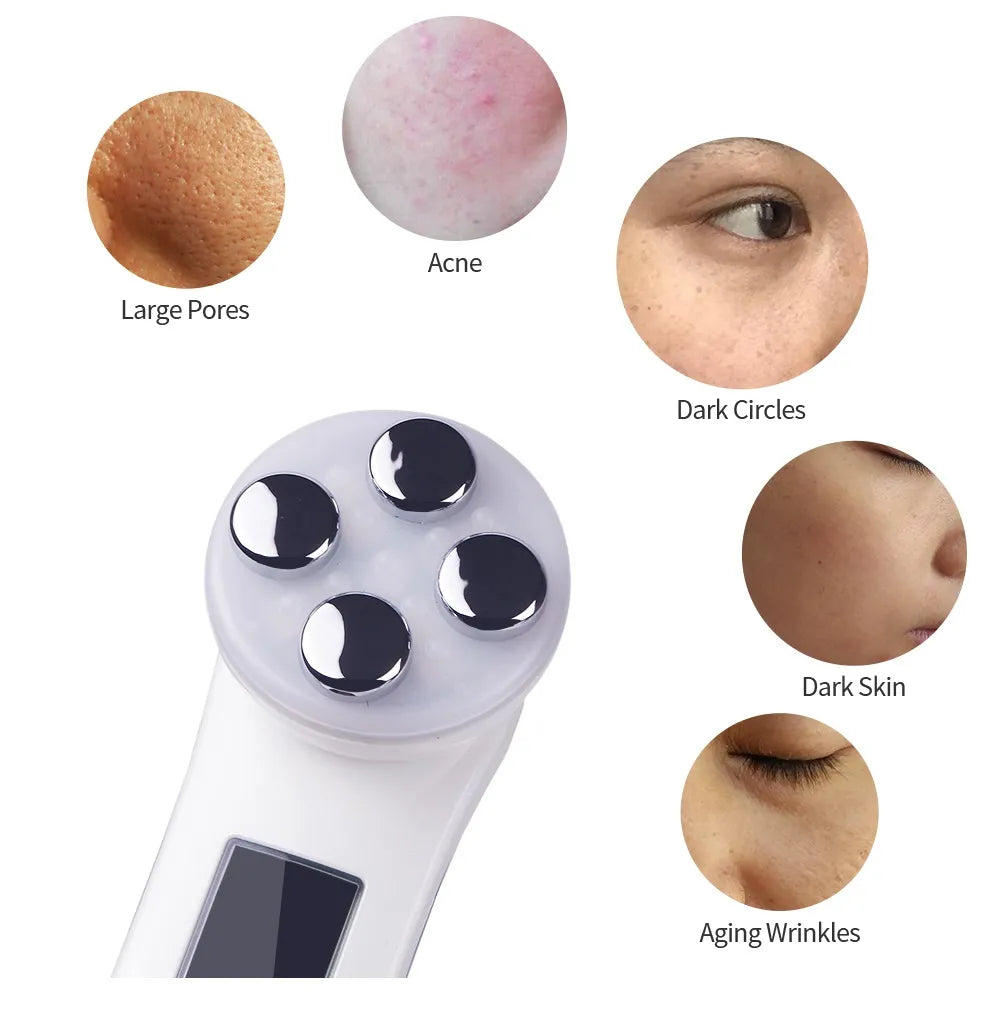 Facial Mesotherapy Electroporation RF Radio Frequency LED Photon Face Lifting Tighten Wrinkle Removal Skin Care Face Massager